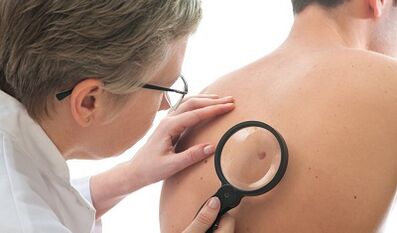 Virus del papiloma humano en hombres