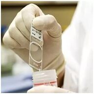 Diagnóstico de infección del papiloma