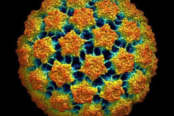 Métodos para diagnosticar el virus del papiloma humano