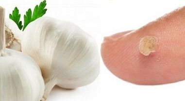 tratamiento de las verrugas con remedios caseros